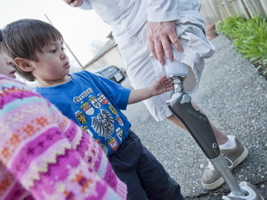 Children Explore the C-Leg Artificial Limb Technology